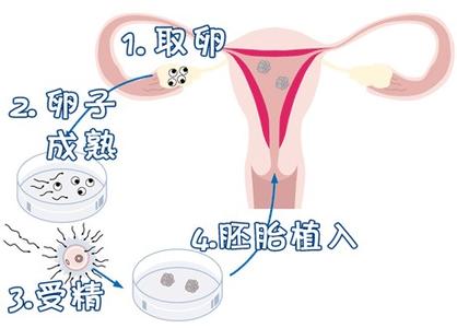 关于极光